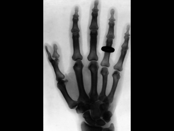18 X Ray Show Seite 100